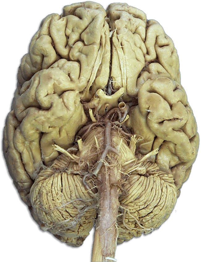 Cranial Nerves in the Brain